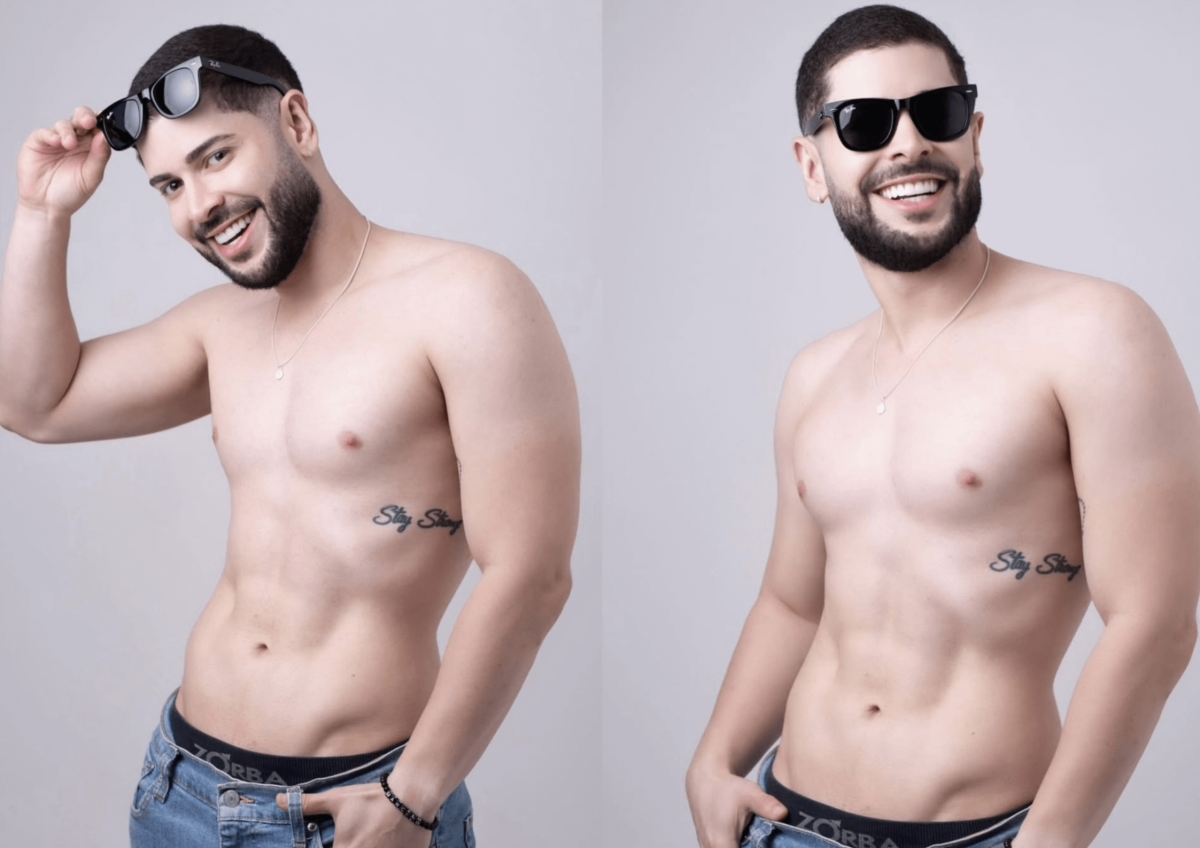 O ex-BBB Marcelo Alves detalha lista de procedimentos estéticos faciais e corporais que já realizou