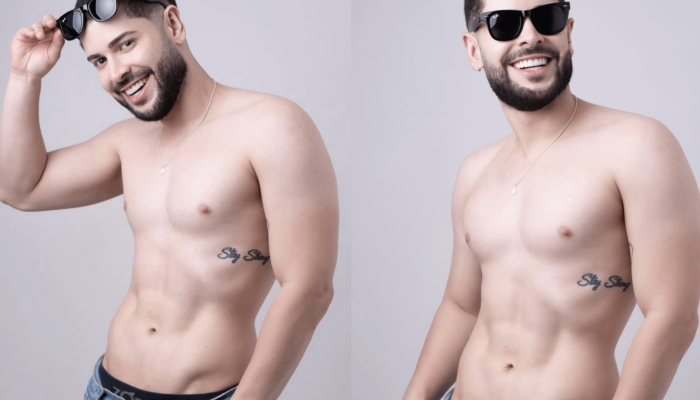 O ex-BBB Marcelo Alves detalha lista de procedimentos estéticos faciais e corporais que já realizou